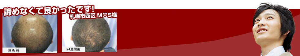 医療機関で行う薄毛対策